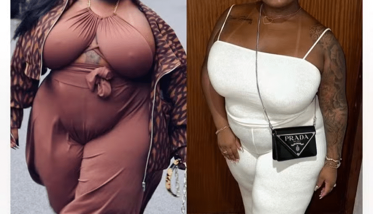 cirugia Jojo Todynho