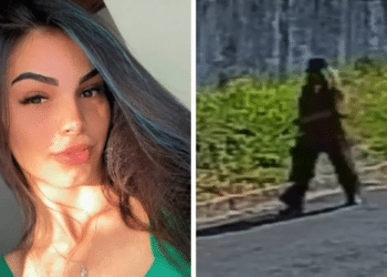 Mulher atacada com ácido e imagem da duspeita