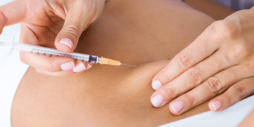 lipo