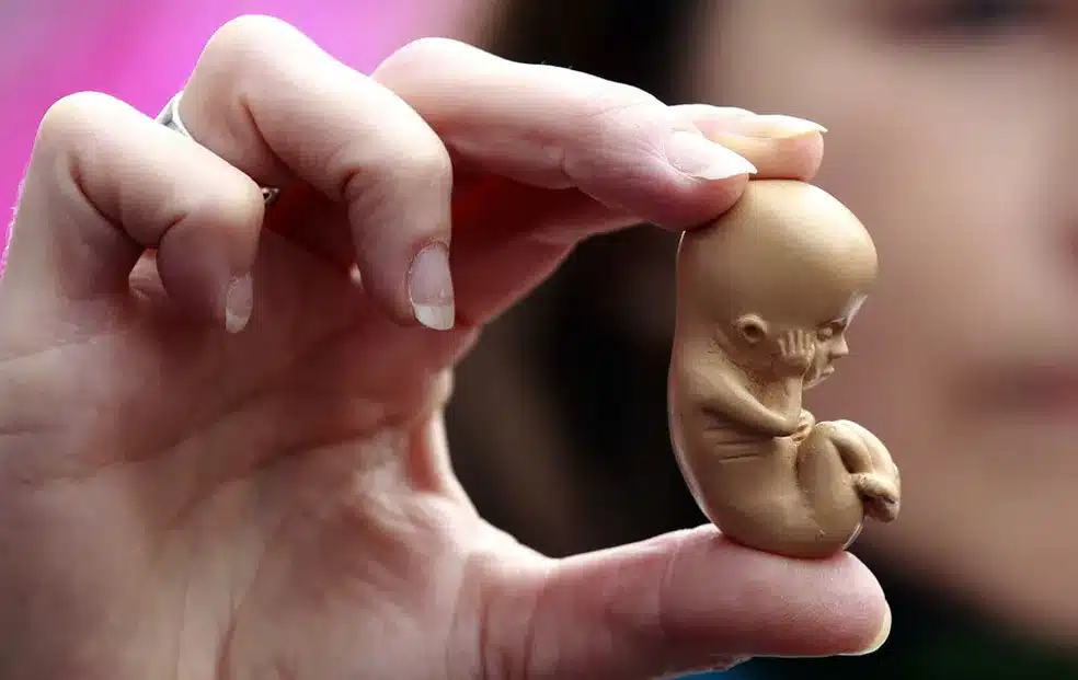 Entenda as leis do aborto no Brasil: seus direitos e limites (Fonte: G1)