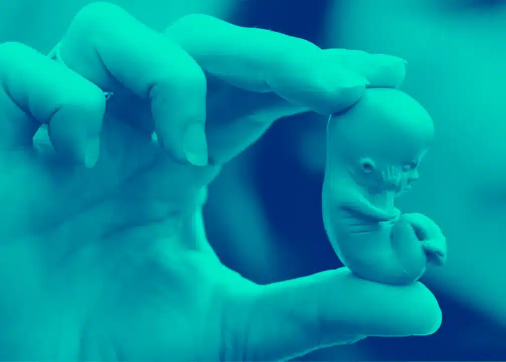 Brasil em Choque: Projeto de Lei Propõe Mudanças Severas na Legislação sobre Aborto no Brasil (Fonte: Diário da Manhã)