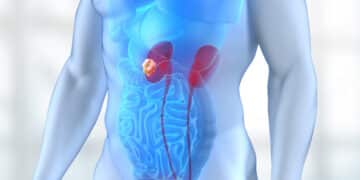 Alerta vermelho! Câncer de rim pode ser fatal: descubra como se prevenir (Fonte: Google)