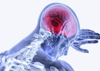 Trombectomia Mecânica: Avanços no Tratamento de AVC no SUS (Fonte: Agência Pará)
