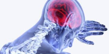 Trombectomia Mecânica: Avanços no Tratamento de AVC no SUS (Fonte: Agência Pará)