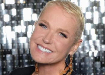 Xuxa revela detalhes chocantes sobre seus 80 procedimentos estéticos em 7 horas (Fonte: Instagram)