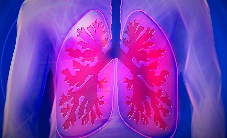 Pneumonia ou Asma? Descubra as Diferenças e Garanta a Saúde dos seus Pulmões! (Fonte: PneumoCenter)