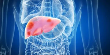 Alerta Vermelho: Cuidado com os Alimentos Venenosos para seu Fígado! (Fonte: Getty Images)