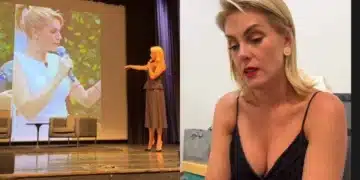 Ana Hickmann hematomas