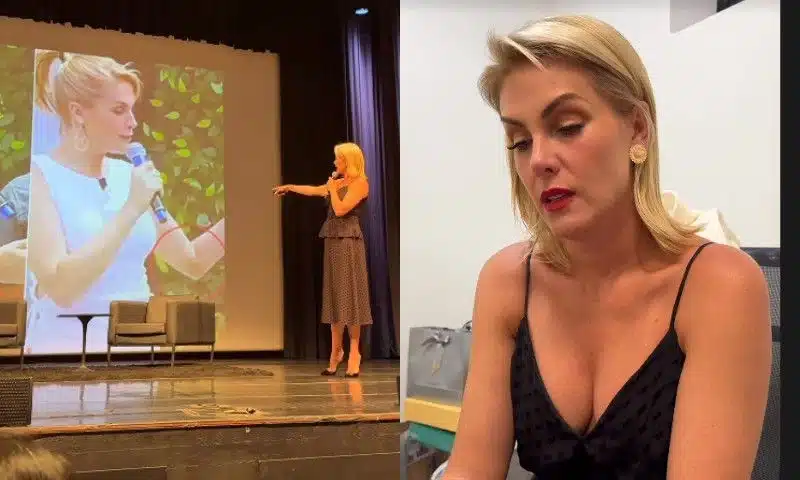 Ana Hickmann hematomas