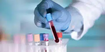 Exame de sangue