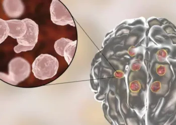 Imagem ilustrativa de cistos no cérebro - Créditos: depositphotos.com / katerynakon